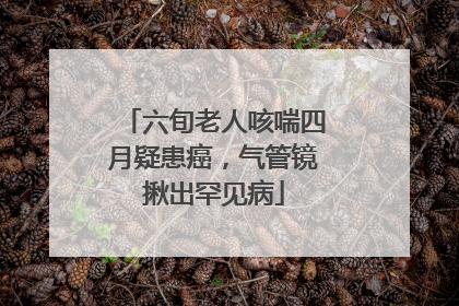 六旬老人咳喘四月疑患癌，气管镜揪出罕见病